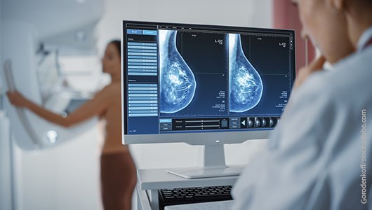 Digitale Vollfeld-Mammographie